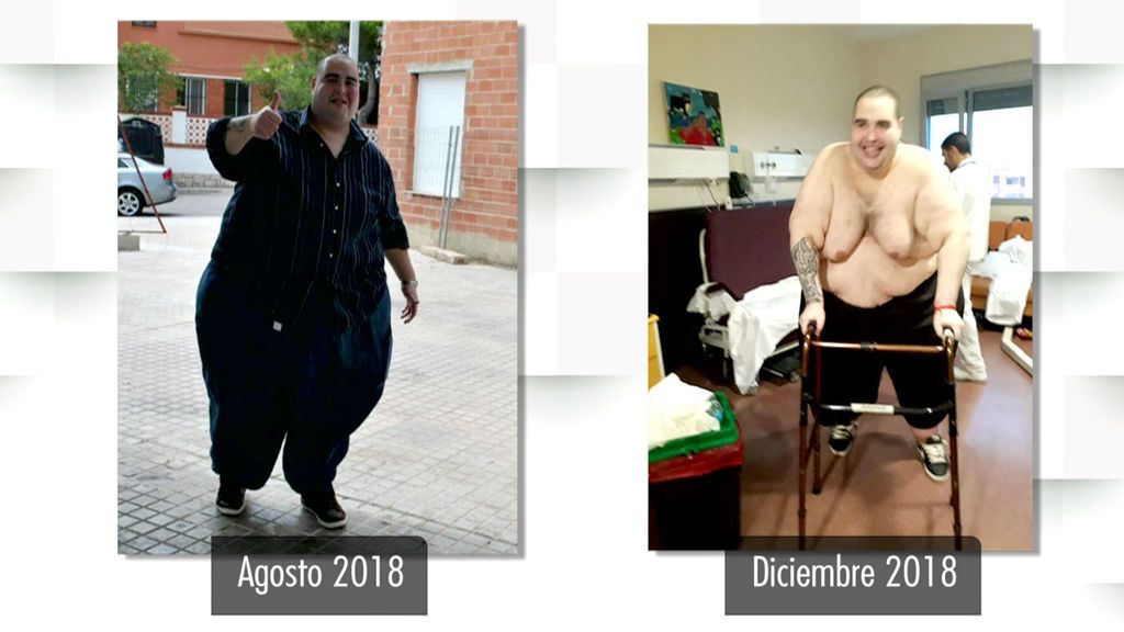 Teófilo ha perdido 100 kilos y recibe el alta médica