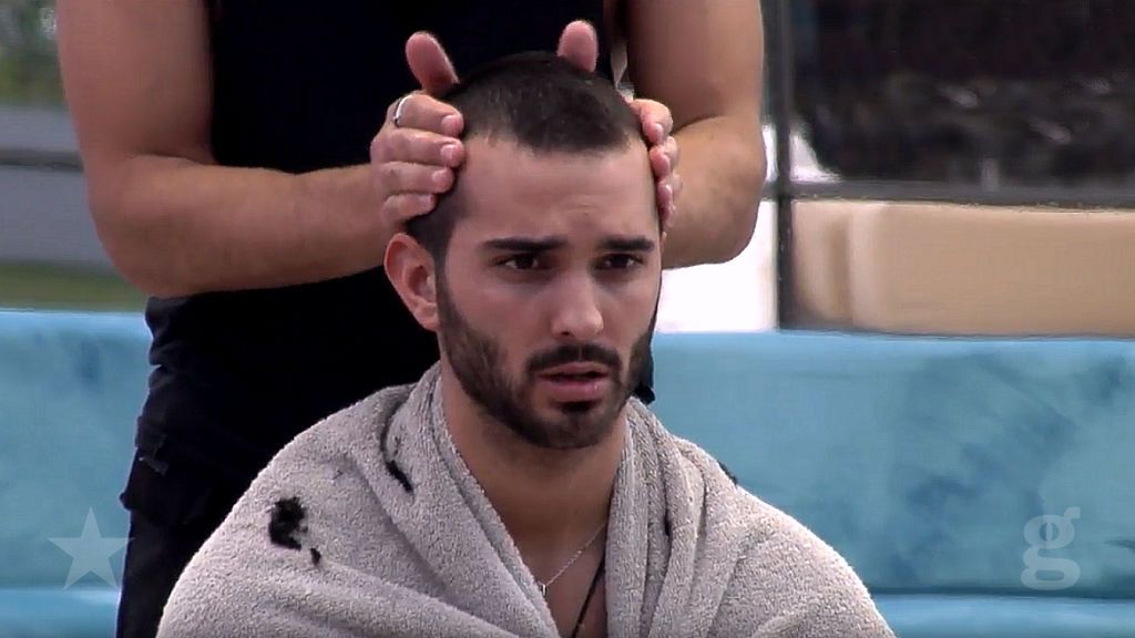 Suso pelado