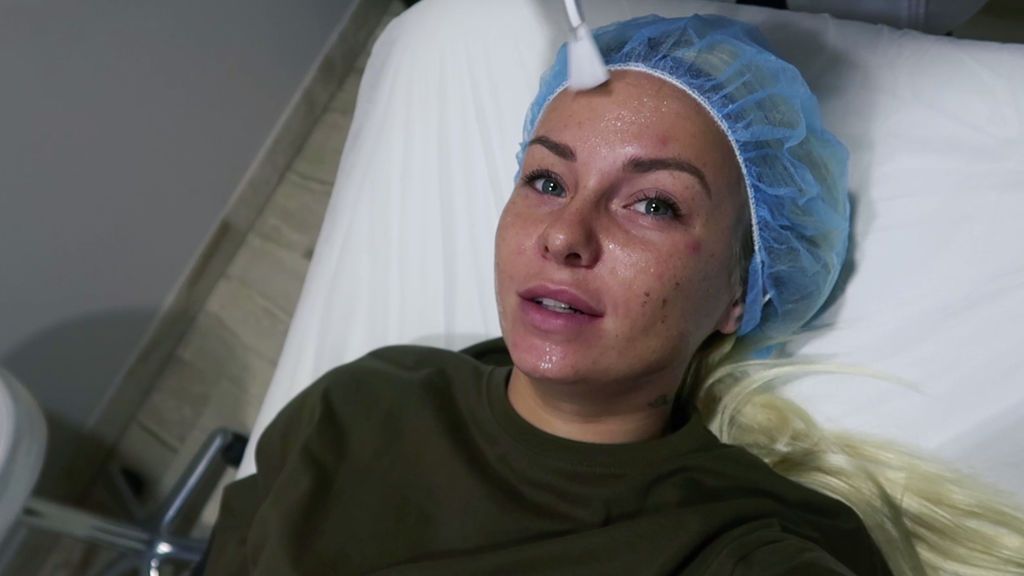 Nicol Hartman 'estrena' cara tras hacerse tres tratamientos faciales (2/2)