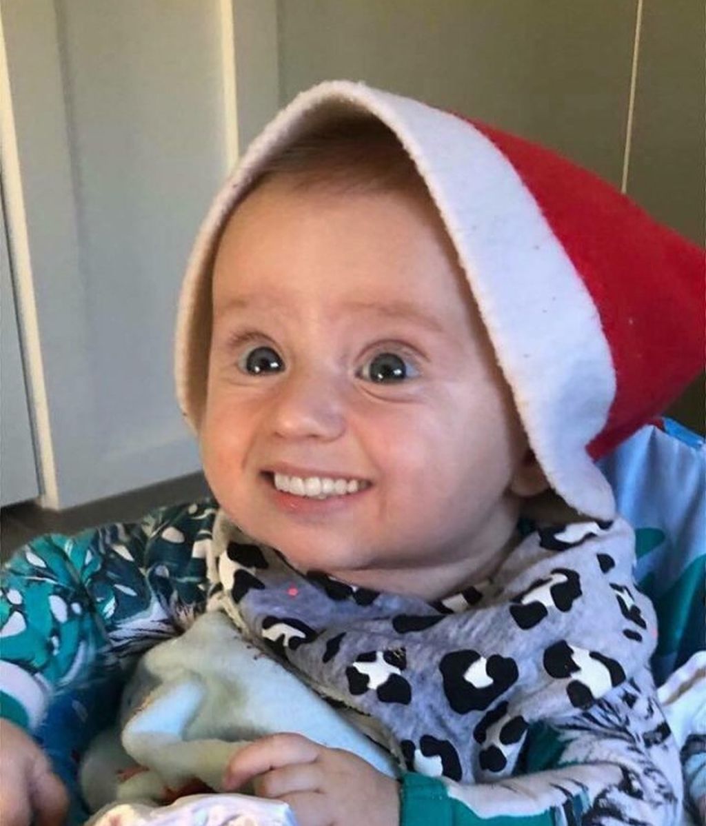 Estos bebés con dientes de adulto arrasan en Internet