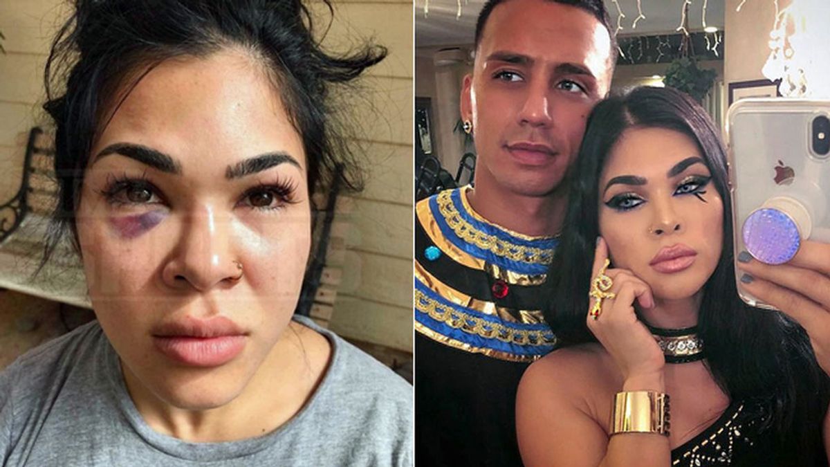 La dramática petición de socorro de la deportista Rachael Ostovich, víctima de violencia machista de su pareja: “Te voy a matar, eres jodidamente guapa” La dramática petición de socorro de la deportista Rachael Ostovich, víctima de violencia machista de su pareja: “Te voy a matar, eres jodidamente guapa”