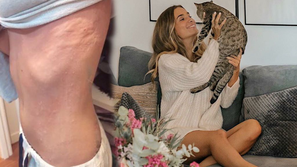 María Pombo no gana para disgustos: su gato le da alergia