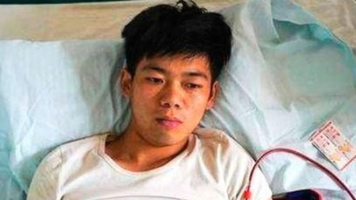 La terrible historia de Wang: vendió su riñón para comprar un iphone y ahora lo paga caro