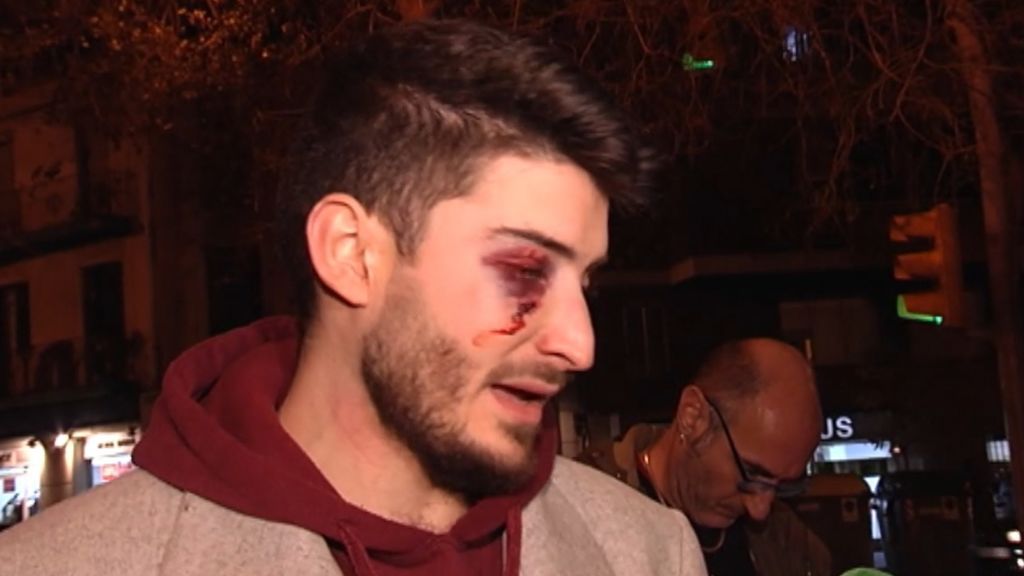 Brutal agresión homófoba a un joven en el metro de Barcelona al grito de "maricón"