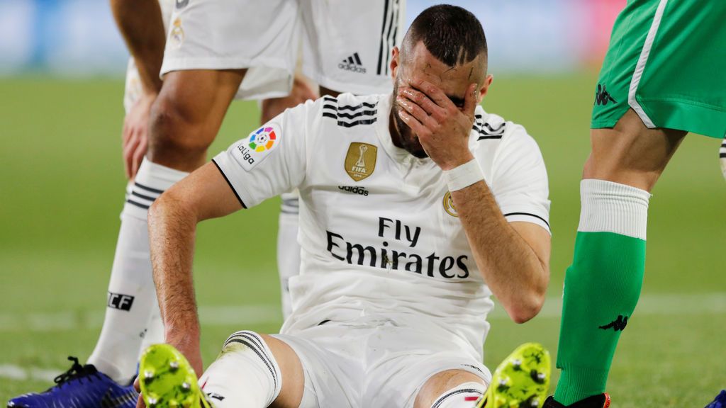 Real Madrid - Así le quedó el dedo a Benzema tras la fractura ante el Betis