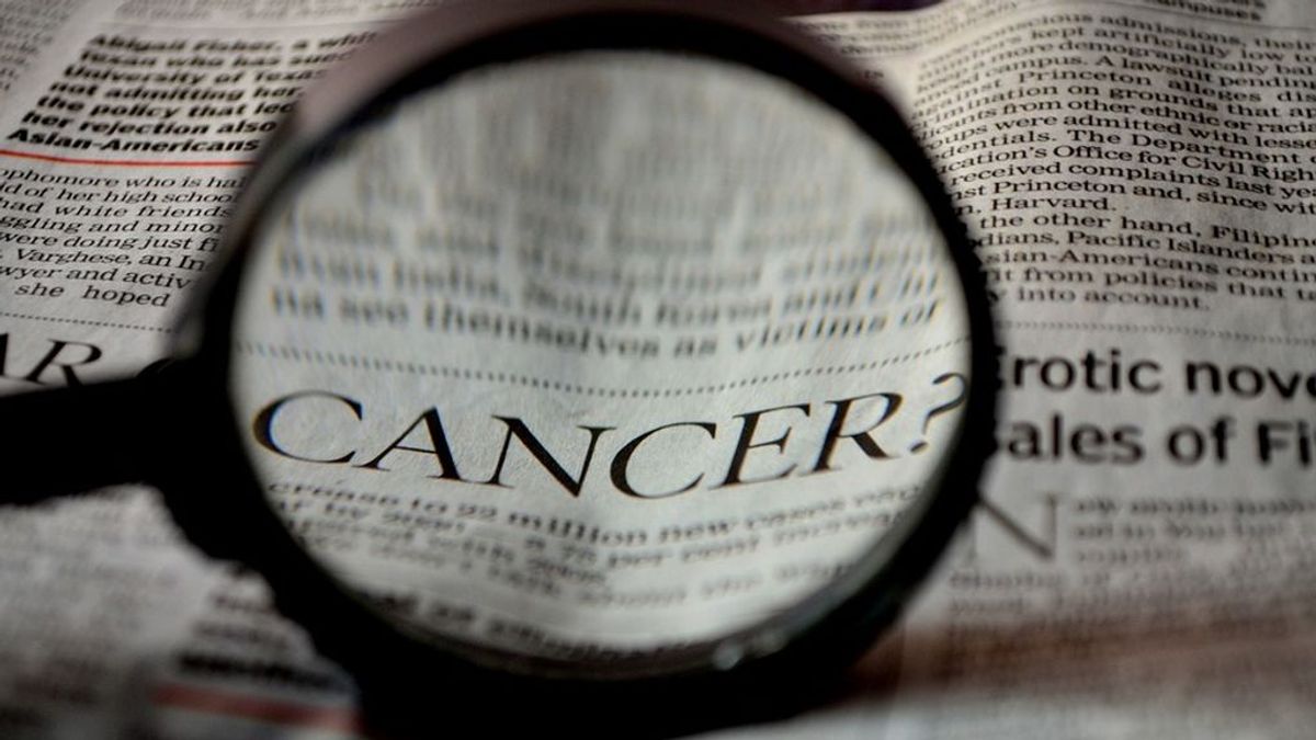 La colitis y la aparición del cáncer de colon están conectadas, según unos científicos estadounidenses