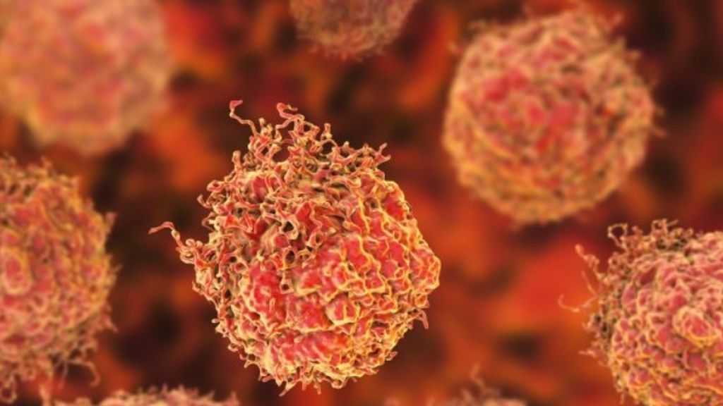 Identifican el gen causante de la propagación del cáncer de próstataa