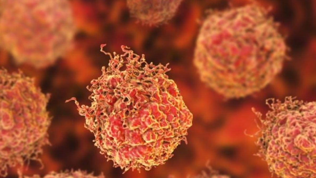 Identifican el gen causante de la propagación del cáncer de próstataa
