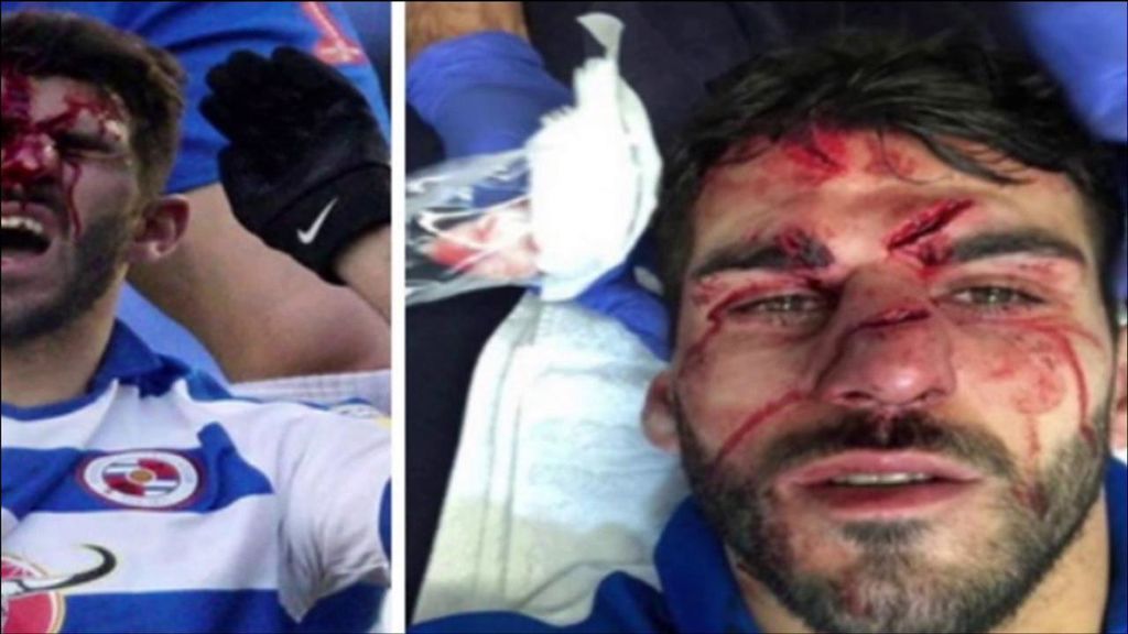 El brutal pisotón en la cara que sufrió Nelson Oliveira en mitad de un partido