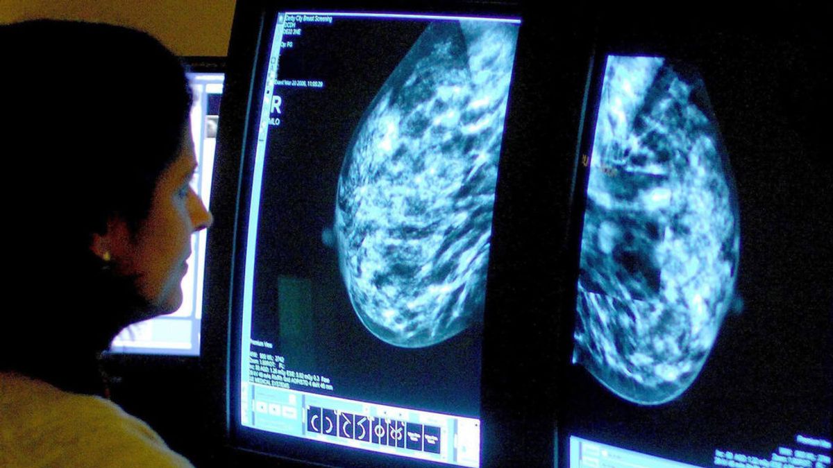 Dolores Aveiro lucha de nuevo contra el cáncer de mama: la importancia de las revisiones tras padecerlo