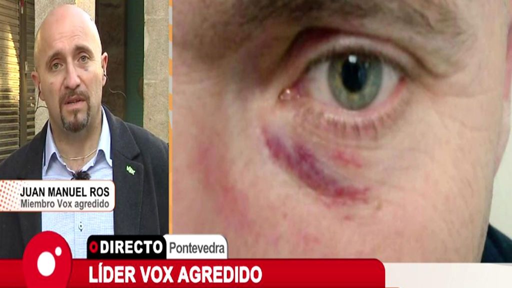 El joven que abofeteó a Rajoy agrede a un miembro de VOX: “Tenía los ojos en sangre”