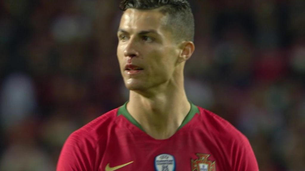 Cristiano se lleva un golpe en la nariz que le hizo sangrar en el Portugal - Serbia