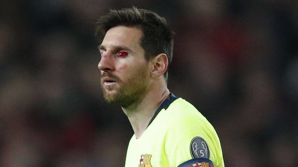 Messi herida