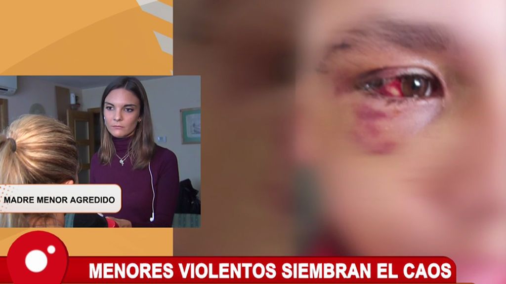 Un grupo de menores le destroza un ojo a un niño porque no les gustó "su mirada"