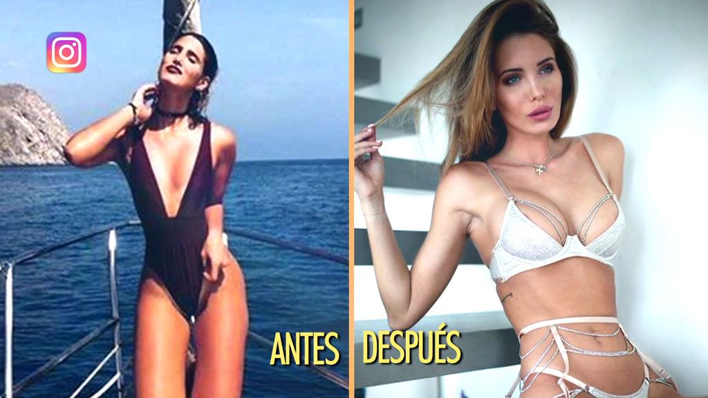 Marta López, la novia de Kiko Matamoros, antes y después de sus retoques estéticos