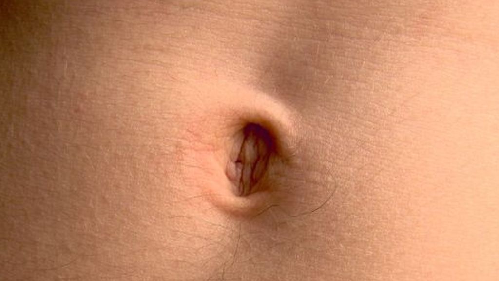 ¿Qué enfermedad puedes tener si te duele el ombligo? ¿Qué enfermedad puedes tener si te duele el ombligo?