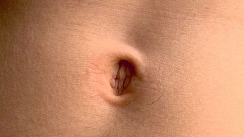 Por Qué Me Duele El Ombligo