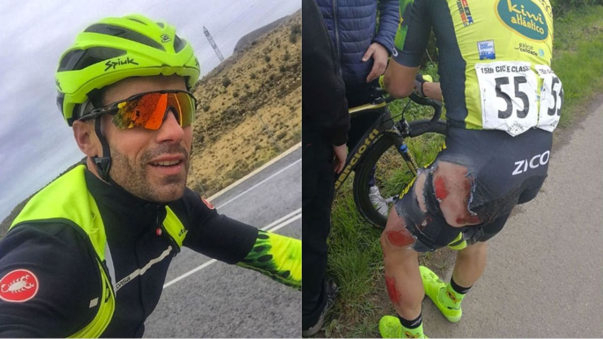 "Ya me quedan menos vidas": Un ciclista español, atropellado por un coche mientras entrenaba en Inglaterra