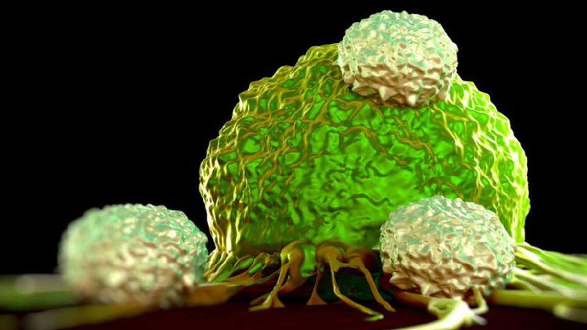 Una nueva investigación identifica cuatro características de la metástasis del cáncer