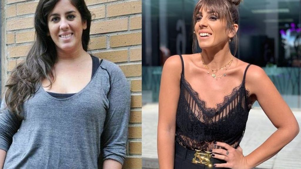 Anabel Pantoja, sobre el anillo gástrico: "Me ha cambiado la vida, perdí 30 kilos"