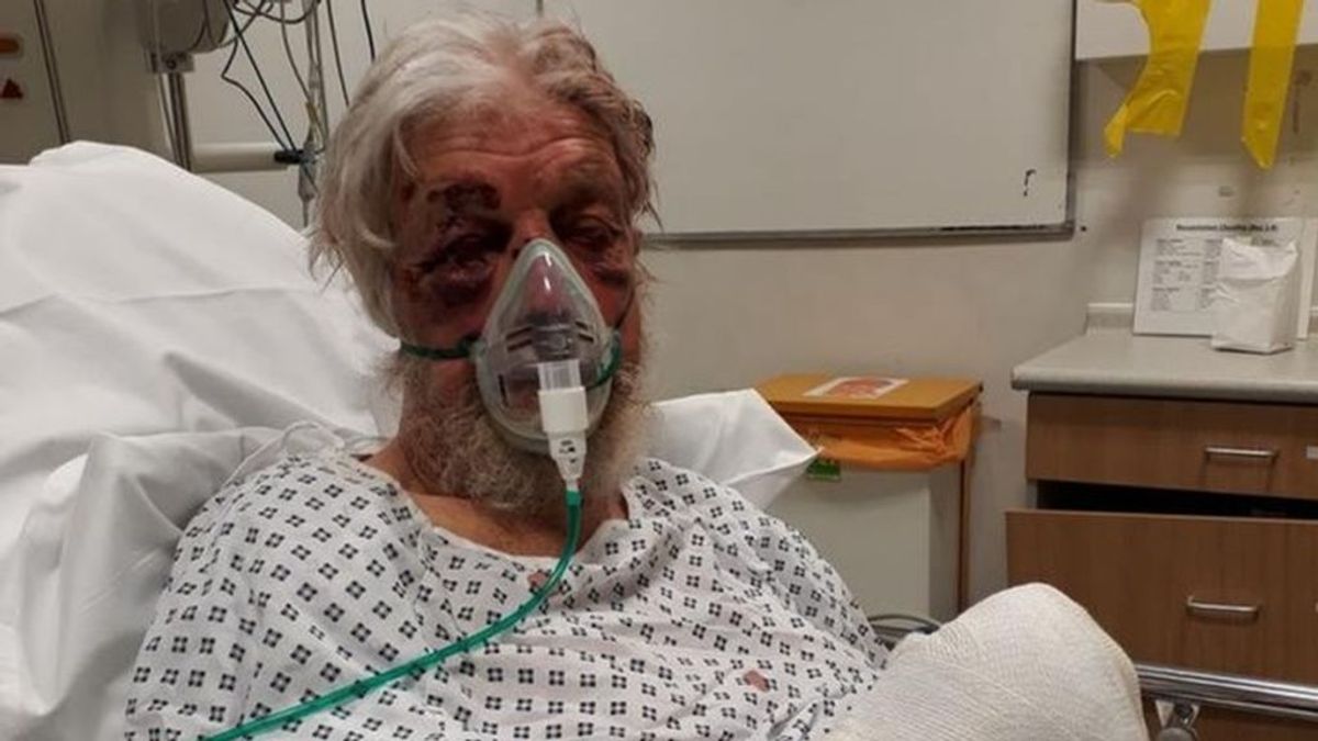 Herido un hombre de 80 años tras ser atacado en Londres