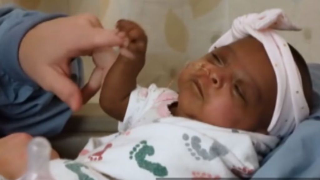 Bebé milagro: sobrevive tras nacer con 245 gramos