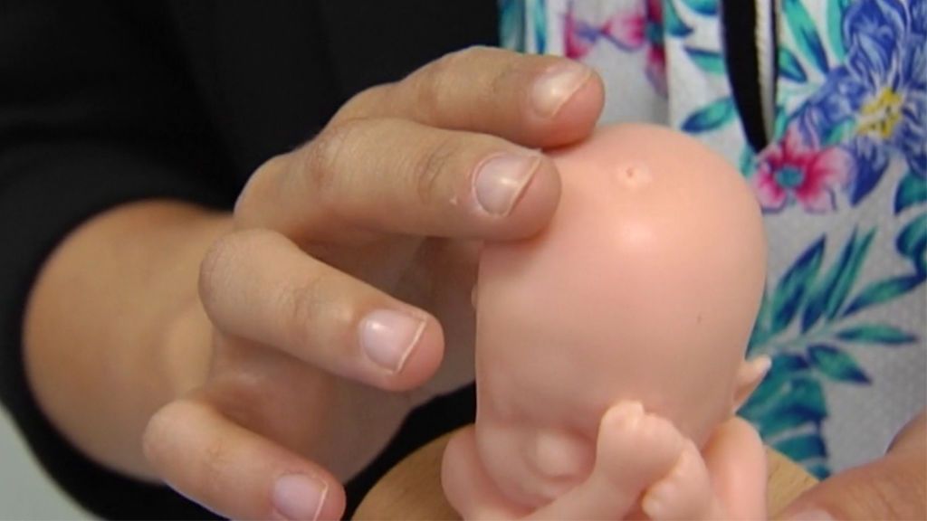 Ecografías 3D para que madres y padres invidentes palpen cómo es el rostro y la postura del bebé antes de nacer