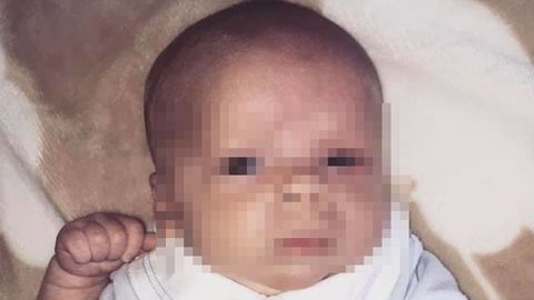 Un Bebe Lucha Por Su Vida Tras Coger Un Herpes Por Culpa De Los Besos En