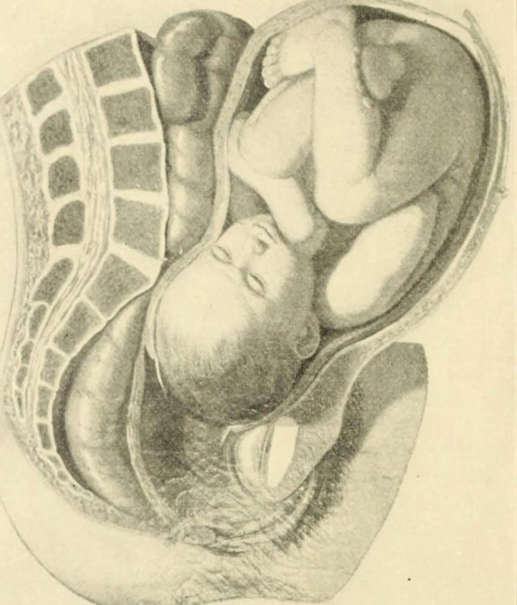 190624 SOC PELVIS FEMENINA