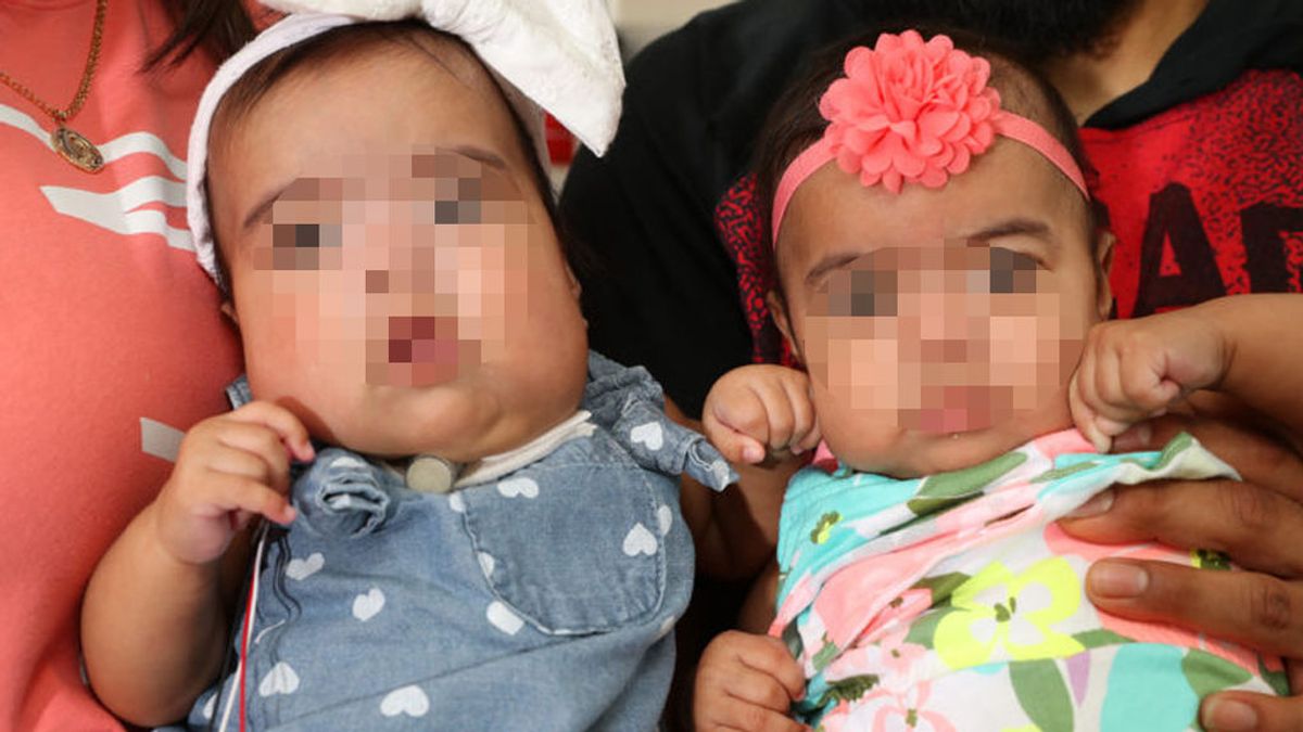 Jenessa, la bebé que fue operada en el útero materno de un tumor, ya está en casa con su hermana gemela