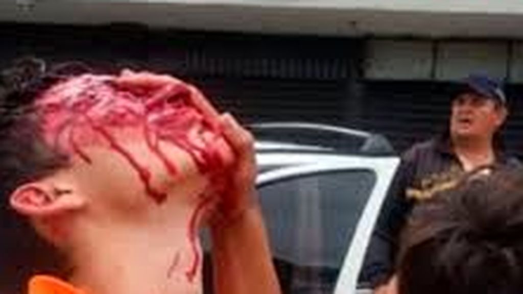Brutal agresión del régimen de Maduro a un niño Brutal agresión del régimen de Maduro a un niño