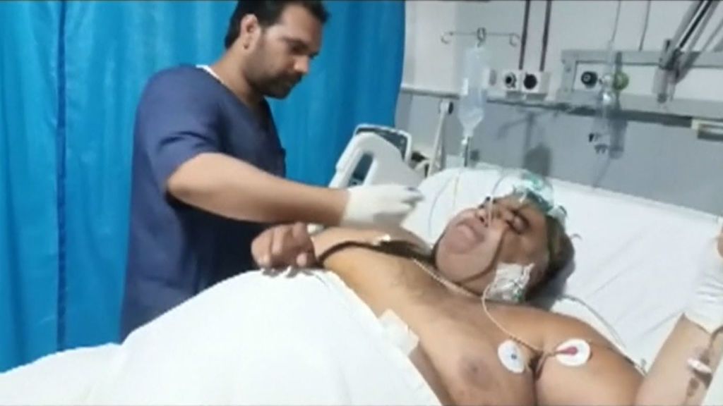 La muerte de un hombre obeso que pesaba 330 kilos conmociona Pakistan