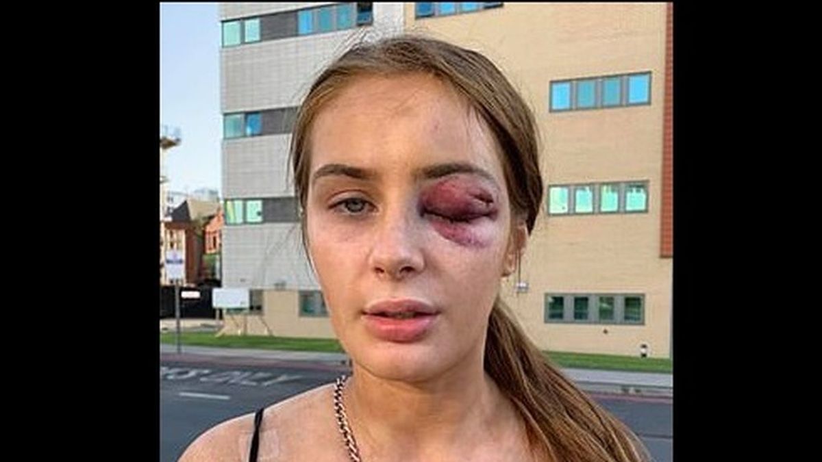 Una joven recibe una paliza en el centro de Manchester por decirle que no estaba interesada en él