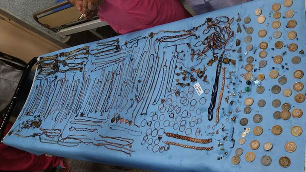 Sacan más de 53.000 dólares en joyas del estómago de una mujer de la India Sacan más de 53.000 dólares en joyas del estómago de una mujer de la India