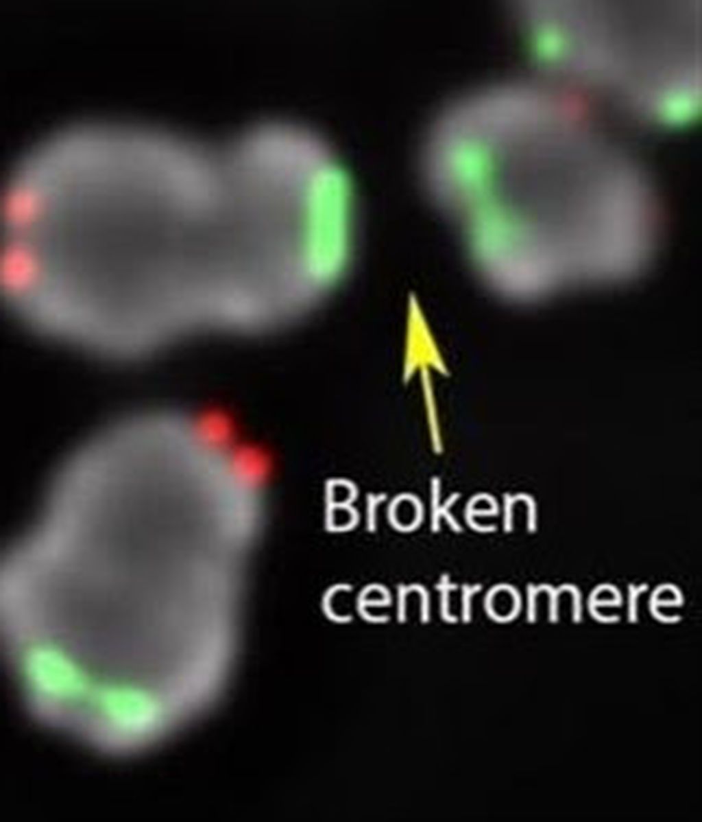 Descubren una proteína que protege contra el daño del ADN y podría ayudar a atacar las células cancerosas Descubren una proteína que protege contra el daño del ADN y podría ayudar a atacar las células cancerosas