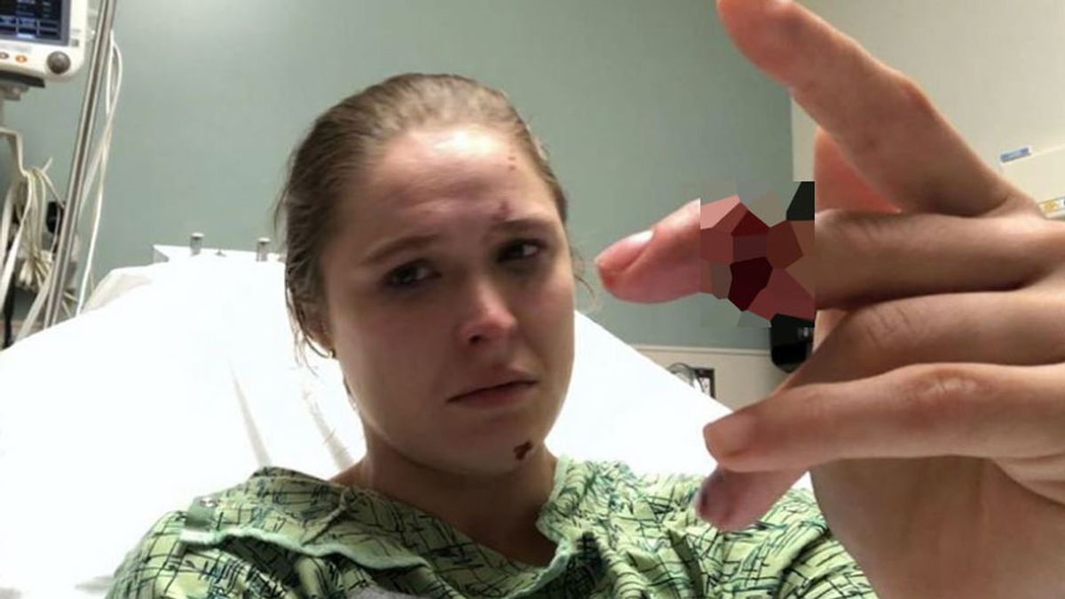 Ronda Rousey, luchadora de la UFC, sufre una amputación parcial de su dedo en la grabación de la serie ‘9-1-1’