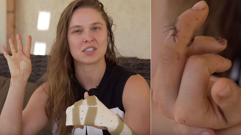 La luchadora Ronda Rousey explica su accidente en el que casi pierde un dedo: "Lo único que tenía que hacer era abrir la puerta del barco” La luchadora Ronda Rousey explica su accidente en el que casi pierde un dedo: "Lo único que tenía que hacer era abrir la puerta del barco”