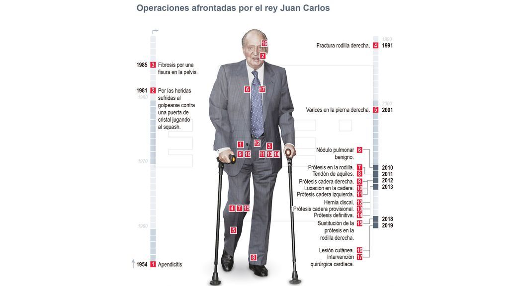 Las 17 operaciones a las que se ha tenido que someter el rey don Juan Carlos