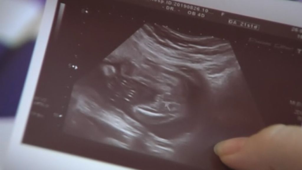 "Piensas primero en tu bebé antes que en ti", el miedo de las embarazadas afectadas por el brote de listeriosis