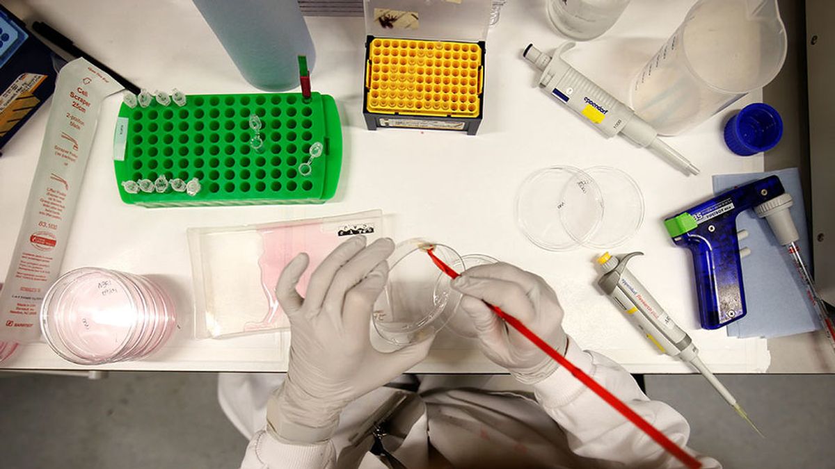 ¿Qué es el cáncer de osteosarcoma? ¿Qué es el cáncer de osteosarcoma?