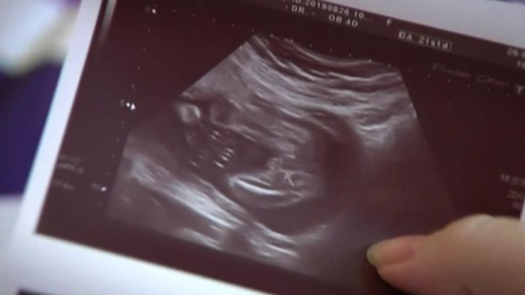 Aborta una mujer embarazada en Madrid por listeriosis, el tercer caso en las últimas horas