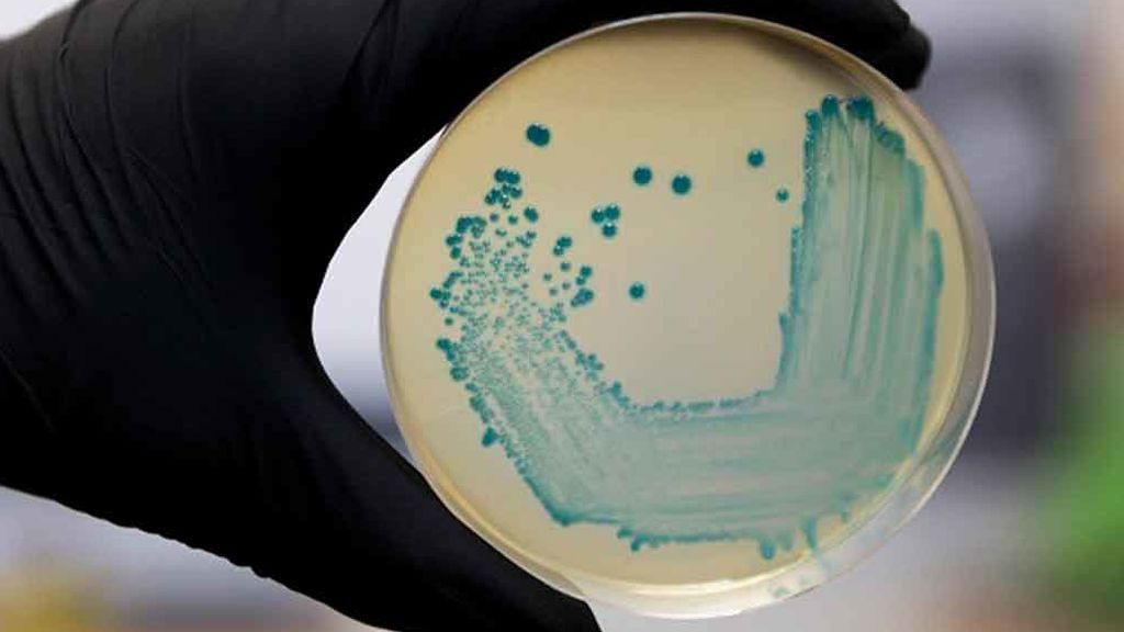 Asciende a 69 el número de hospitalizados por el brote de listeriosis en Andalucía Asciende a 69 el número de hospitalizados por el brote de listeriosis en Andalucía