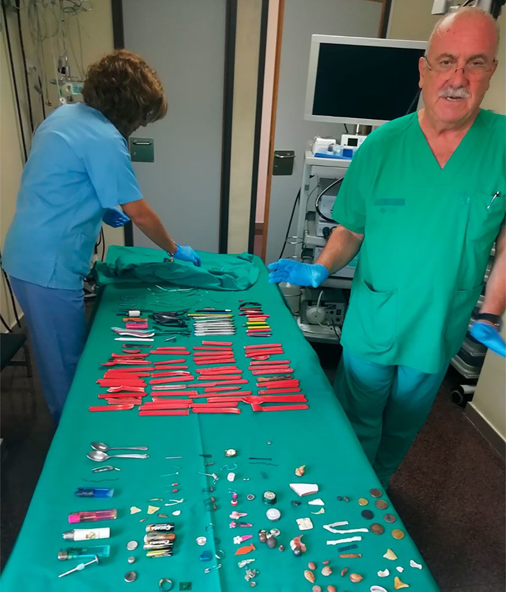 El doctor Casellas junto a objetos extraídos del estómago de sus pacientes