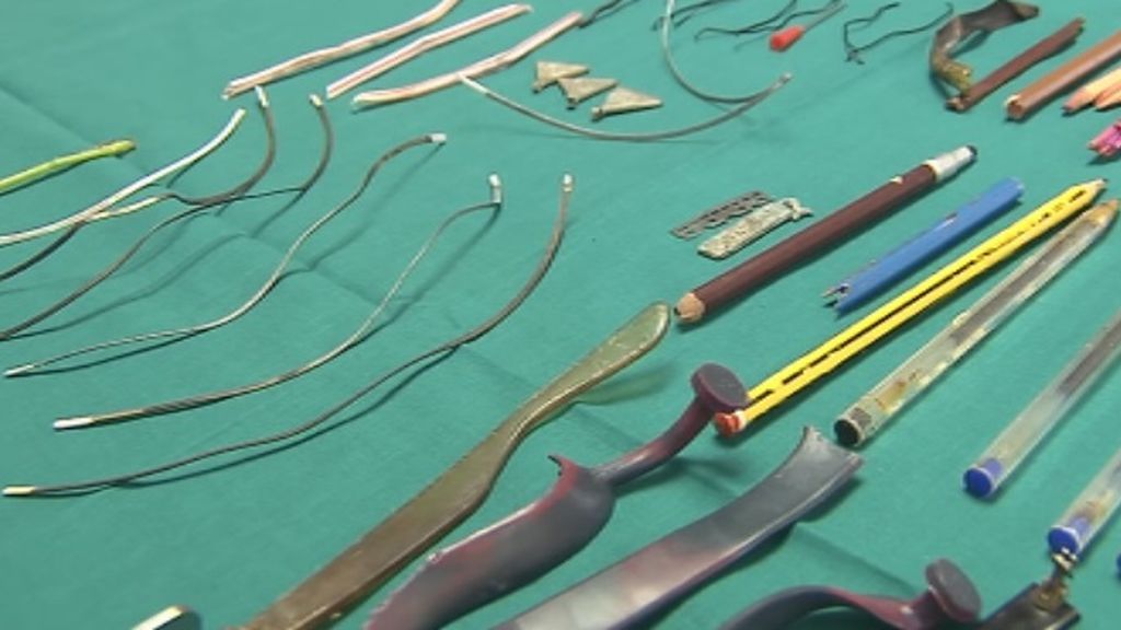 Un médico reúne los objetos que ha extraído de los estómagos de sus pacientes