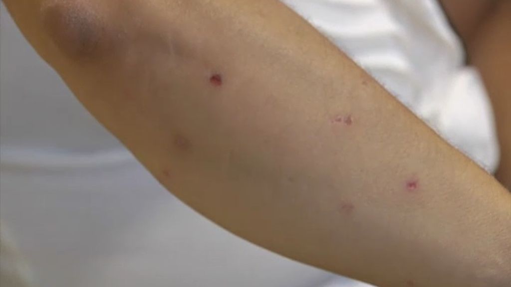 Las plagas de mosquitos invaden Elche