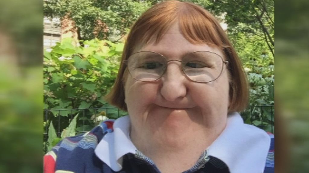La periodista discapacitada se burla de los trolls que la llaman "demasiado fea" para los selfis