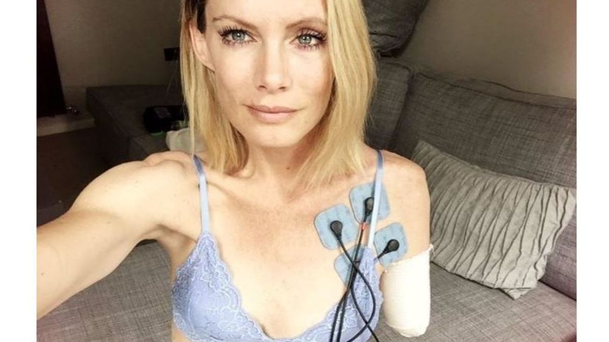 El drama de la especialista que perdió un brazo en un rodaje: el estudio no paga las facturas médicas