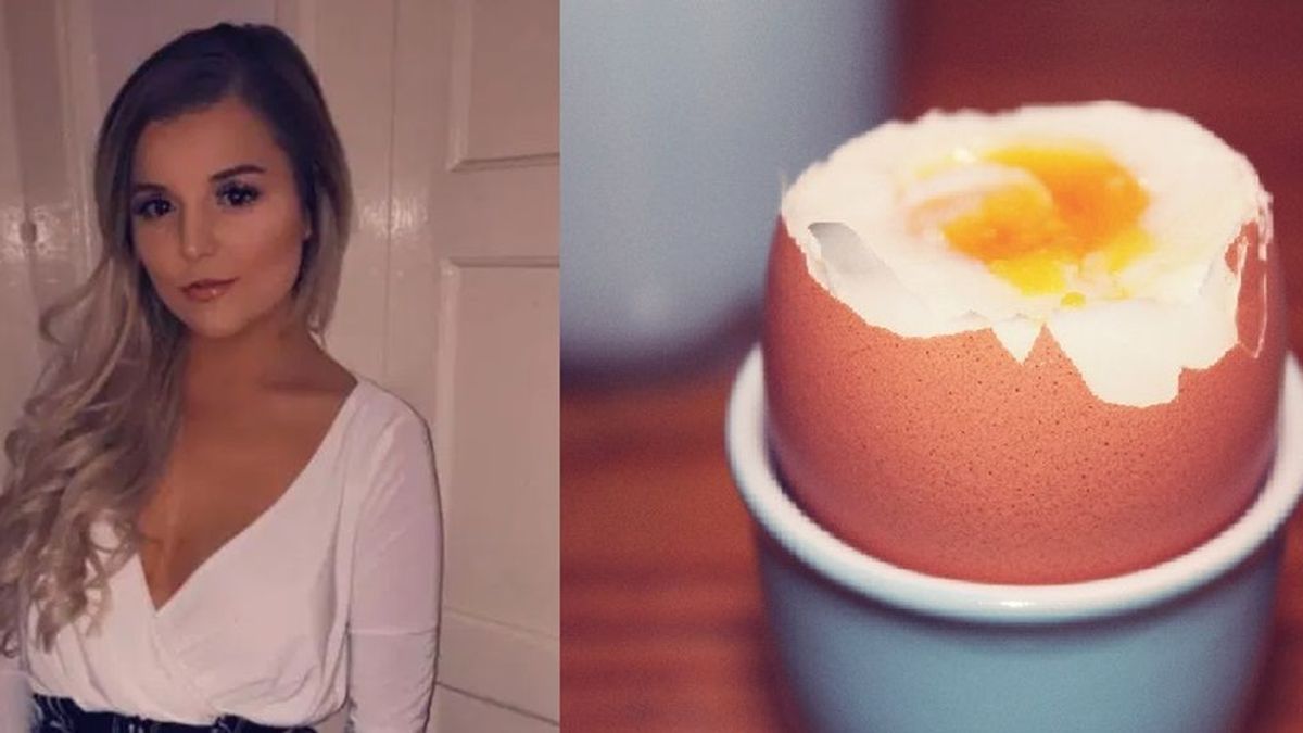 Los peligros de meter huevos en el microondas: a una joven le explotan al sacarlos y se queda ciega de un ojo