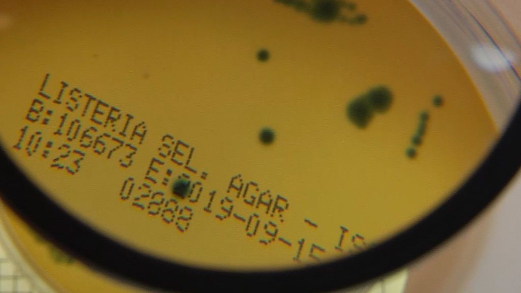 cultivo listeria aumento