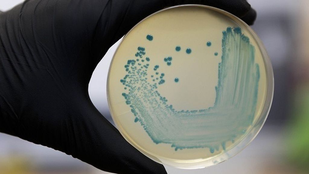Magrudis supo en febrero que su carne mechada estaba contaminada por listeria